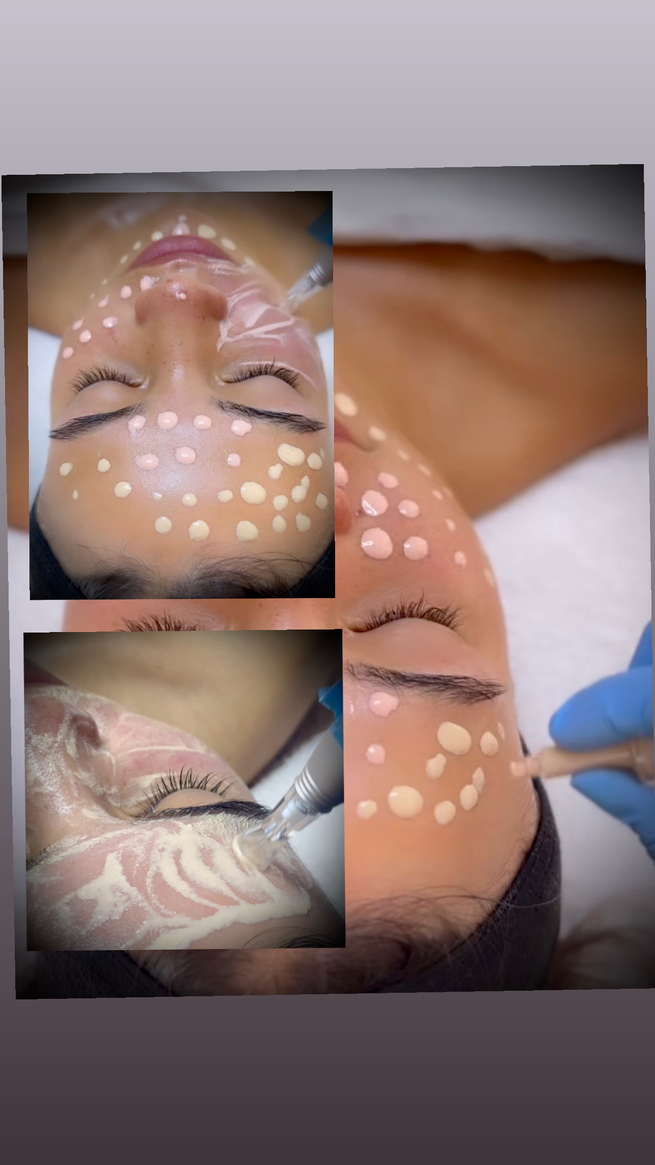 BB glow treatment
